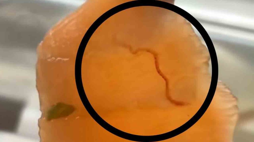 VERMI NEL SUSHI: scandalo dal ‘cinese’ più famoso d’Italia | Lo mangi e ti prendi 7 malattie diverse