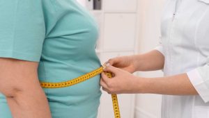 Donna obesa