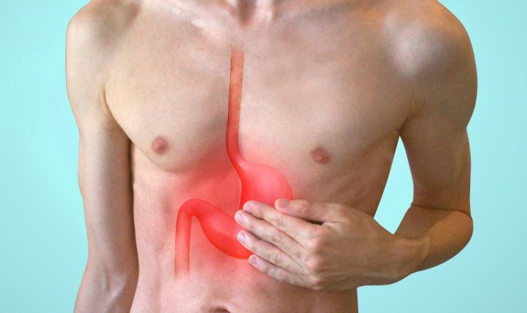 Reflusso gastroesofageo (web) - Infoiva.com